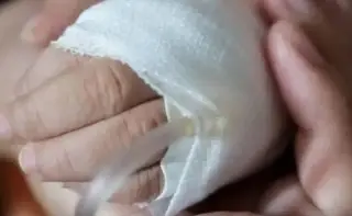Cancelar Normas Oficiales relacionadas con el cáncer de mama deja incertidumbre: Médico
