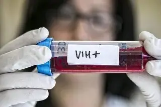 Veracruz entre los primeros lugares con casos de VIH a nivel nacional