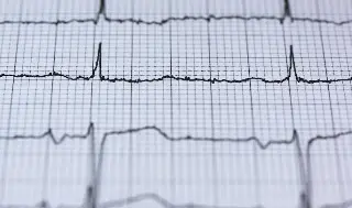 ¿Cuáles son las principales enfermedades cardiovasculares? 
