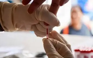 Este es el número de casos con VIH/SIDA actualmente en Veracruz