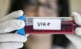 ¿Cómo evitar contagiarse de VIH-Sida? Esto dice Cruz Roja  